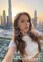 Anna HOT